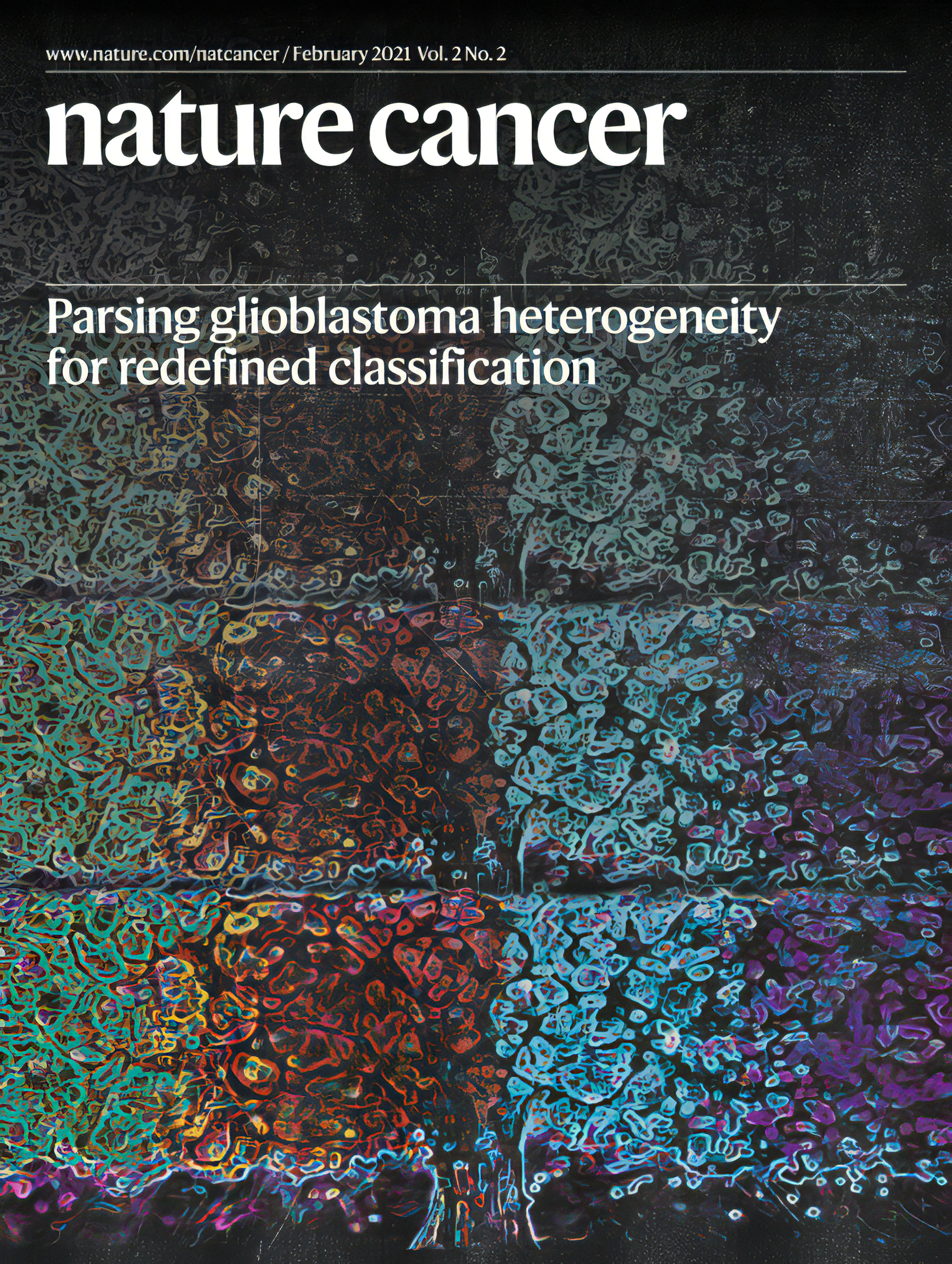 Parsing glioblastoma heterogeneity for redefined classification